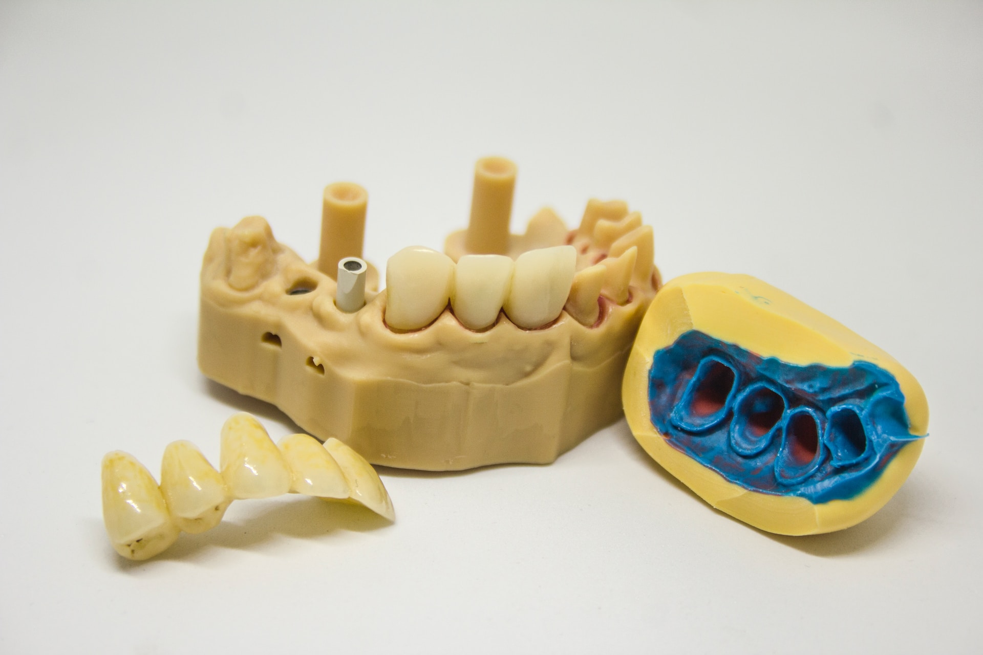 Prevent Gum Disease
